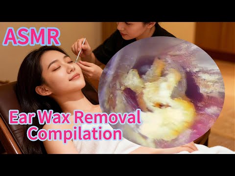 ASMR l Ear Wax Removal Compilation l Super stress relief (4K)