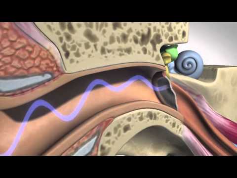 How Hearing Works - Anatomy