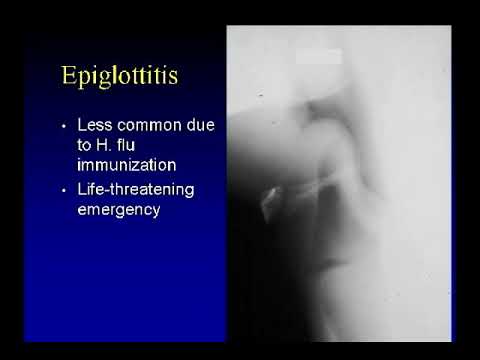34   Pediatric Chest   Airway