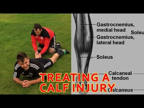 Top Tips for Treating a Calf Strain