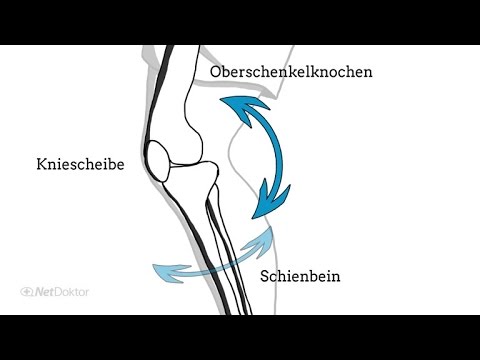 Bauchschmerzen und Rückenschmerzen von 37 Wochen der Schwangerschaft Wunder Unterleib und die untere Rücken und die Beine schmerzen