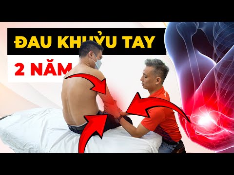 Mệt Mỏi Với Đau Khuỷu Tay Không Dứt? Bí Quyết Đơn Giản Giúp Bạn Hết Đau