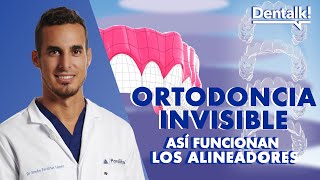 ORTODONCIA INVISIBLE sin brackets - Guía definitiva sobre ALINEADORES TRANSPARENTES | Dentalk! ©