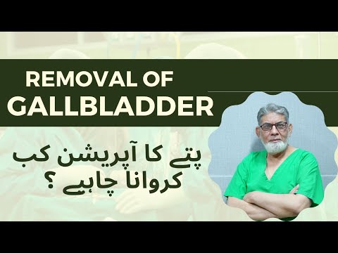 Gall Bladder Surgery: When to have? | Urdu | | Prof Dr Javed Iqbal |