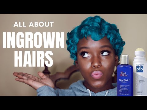 Ingrown Hair Q&A | PFB Vanish, Tendskin, Hyperpigmentation