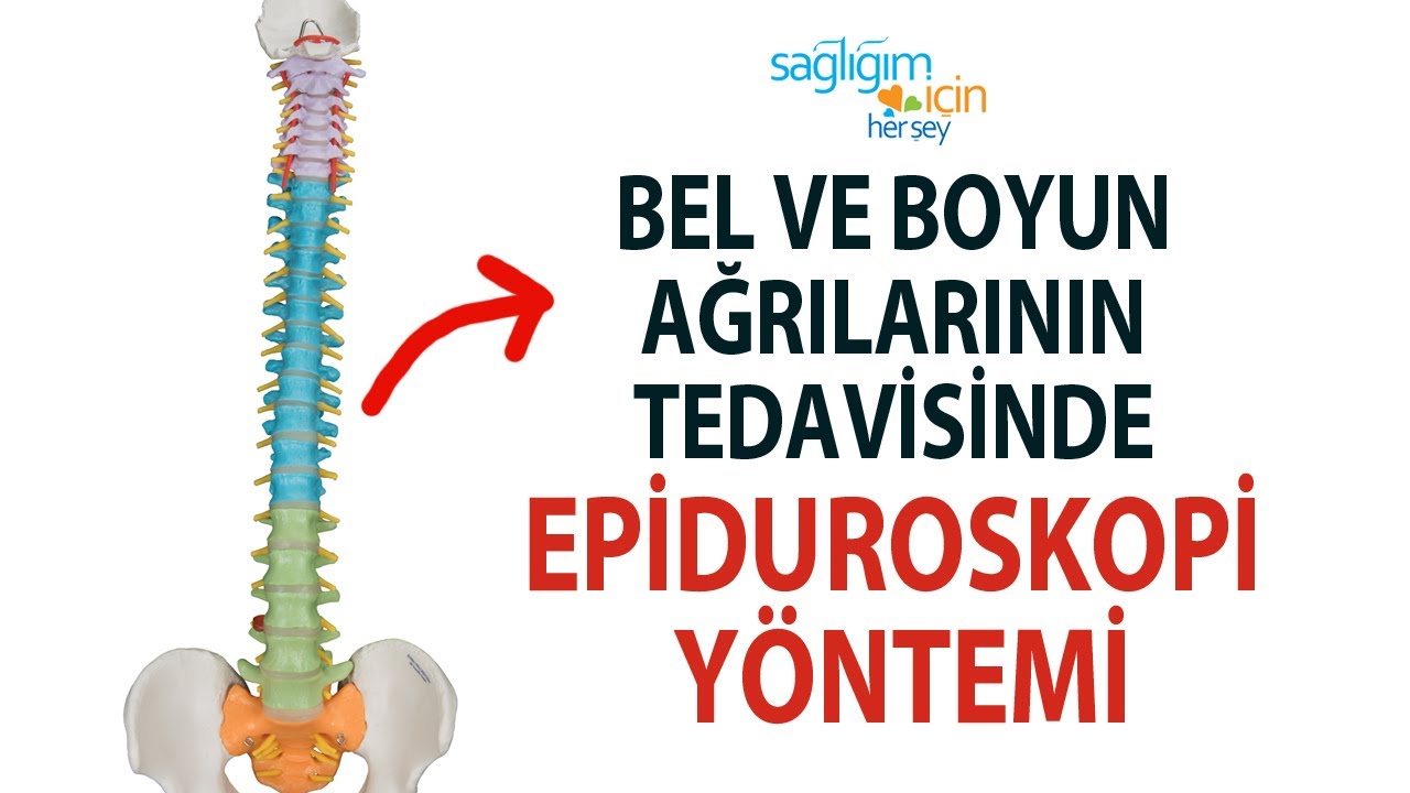 Bel ve Boyun Ağrılarının Tedavisinde Epiduroskopi Yöntemi