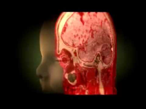 Inside the Living Body DVD