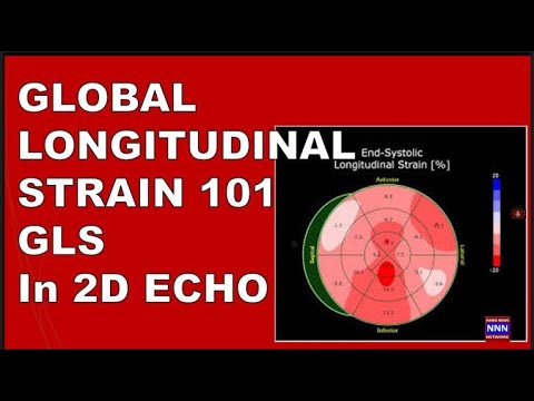 Global Longitudinal Strain  GLS 101 by 2D Echo | Dr Nik Nikam