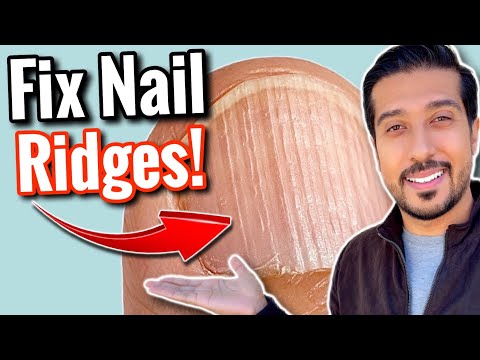 Vertical Ridges on Nails | What Are Your NAILS Trying to Say?