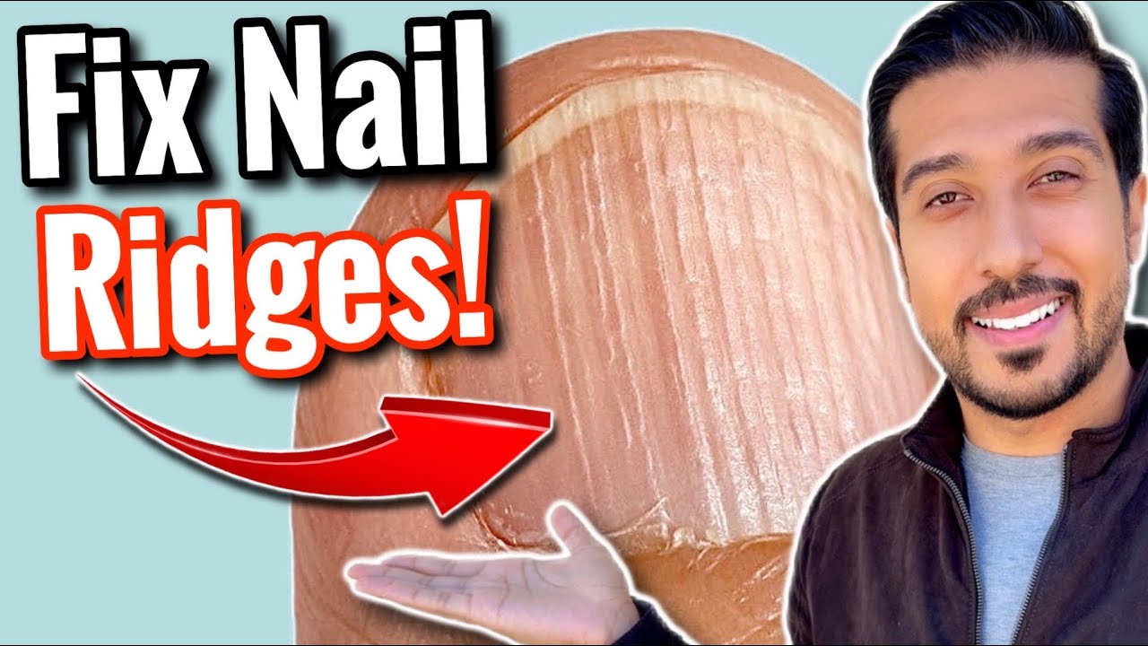 Vertical Ridges on Nails | What Are Your NAILS Trying to Say?