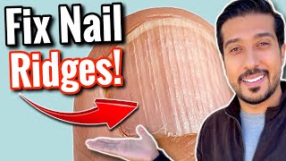 Vertical Ridges on Nails | What Are Your NAILS Trying to Say?