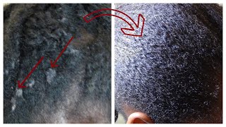 2 Ways to Completely Remove Lint/Buildup From Hair | Back2NaturalGirls