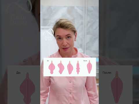Лабиопластика. Гинекология клиники ЛадаЭстет