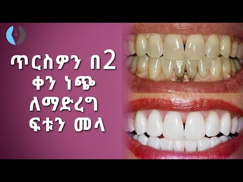 Ethiopia: ጥርስዎን በ2 ቀን ነጭ ለማድረግ ፍቱን መላ | Whiten Teeth With Two Days