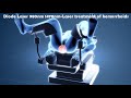 Laser Hemorrhoidoplasty (LHP) - IBI Healthcare Institute