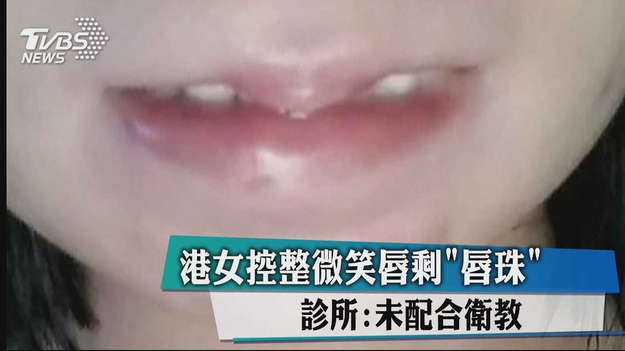 港女控整微笑唇剩「唇珠」 診所:未配合衛教