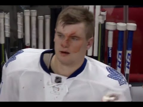 Byron Froese bloody After Face planting following Hit From Malone