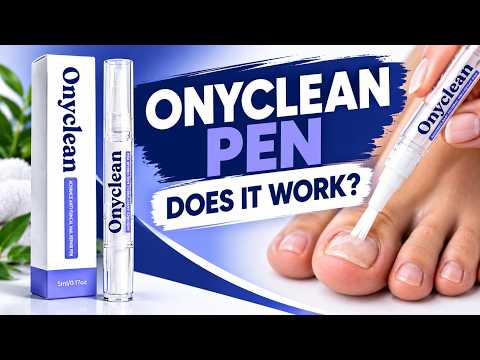 🔥 ONYCLEAN ANTI FUNGAL PEN REVIEW – DOES IT REALLY WORK? RESULTS & CUSTOMER REVIEWS