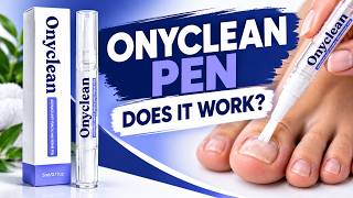 🔥 ONYCLEAN ANTI FUNGAL PEN REVIEW – DOES IT REALLY WORK? RESULTS & CUSTOMER REVIEWS
