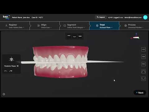 Occlusal Plane