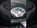 scanner abdominale pelvienne