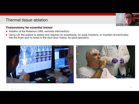 MetaMAT’s 9th webinar S3 - 13.12.2022 - Presentation - Noé Jiménez