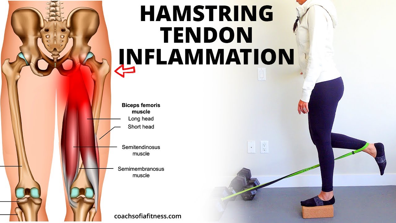 Hamstring Tendinopathy: Best Relief Exercises (Causes and How to Heal Tendinitis)