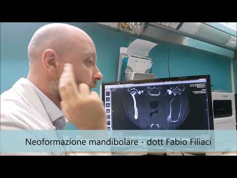 Che dolore vitamine nelle articolazioni bere Esercizio video trattamento dellartrosi