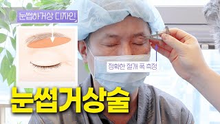 10년은 젊어지는 눈성형 💕 중년눈성형 TOP 3 #111의원