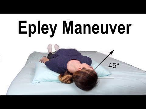 Epley Maneuver to Treat BPPV Dizziness