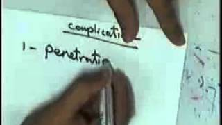 systemic pathology:digestive system 3 peptic ulcer gastric cancer DR SAMEH GHAZY