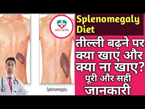 Splenomegaly Diet