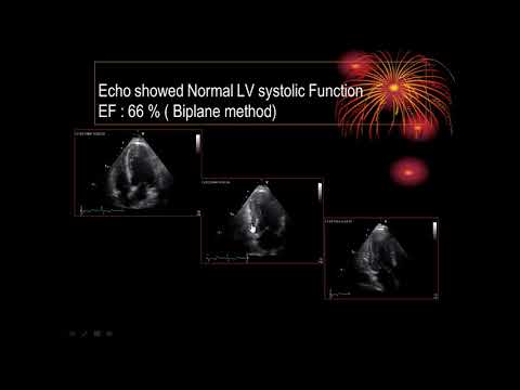 Diastolic Dysfunction , Part I , 060920