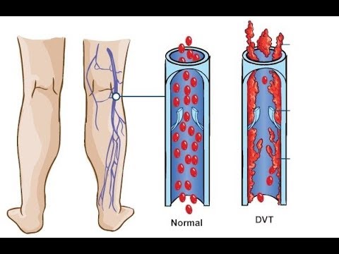 Tengo los pies siempre fríos: ¿a qué se puede deber?
