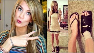NEW Hair + Foot Injury LIFE UPDATE!