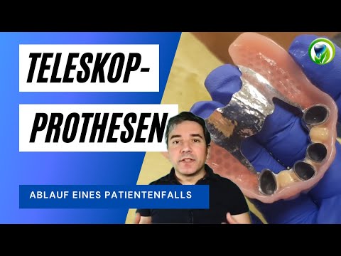 Teleskopprothesen : #Ablauf der Behandlung, #Patientenfall, #Teleskope, herausnehmbarer Zahnersatz
