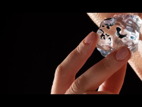 Mal di linfonodi nel collo, e fa sì che la temperatura Se torna male dolente che si può fare