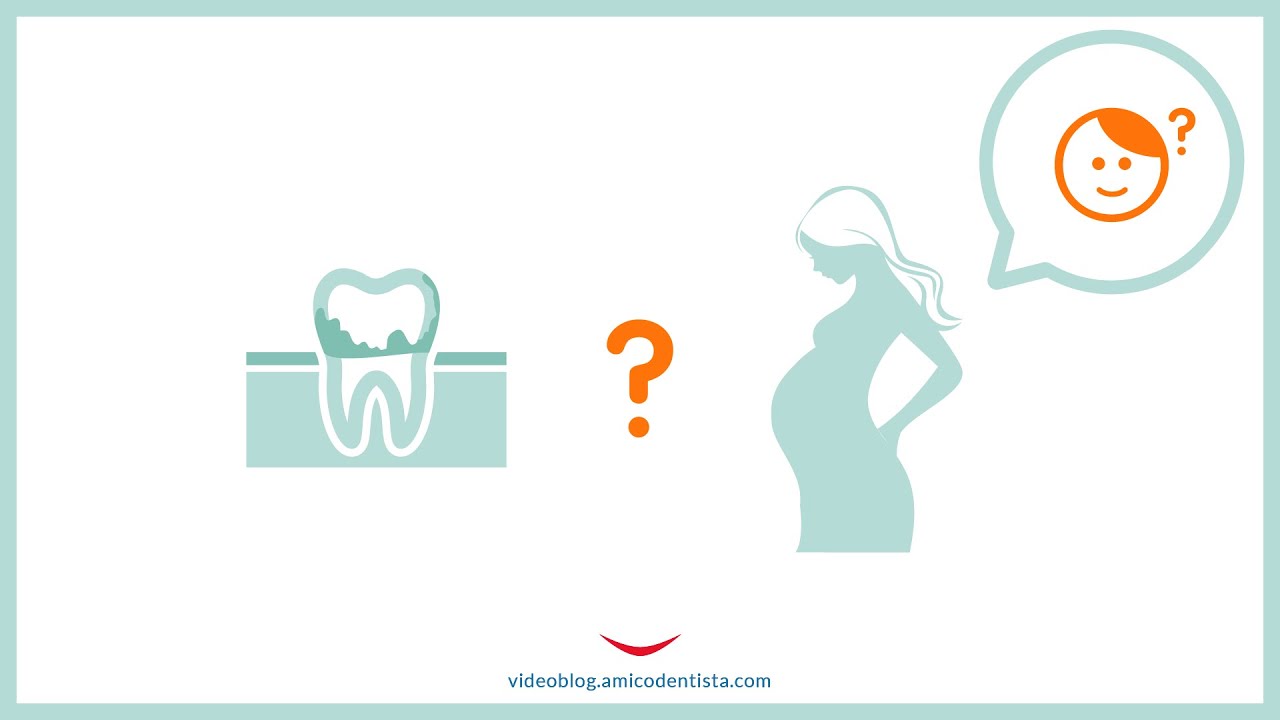 Gengivite in gravidanza Ecco come trattare gonfiore e dolore