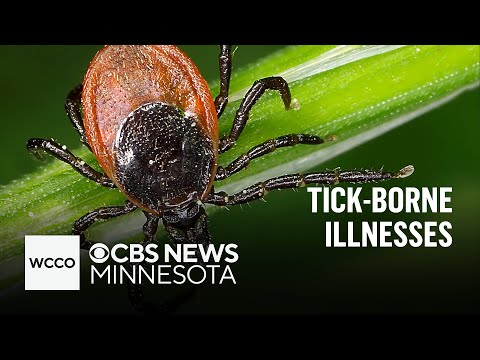 Ticks may be worse after the mild winter. What to know about tick-borne diseases | Talking Points