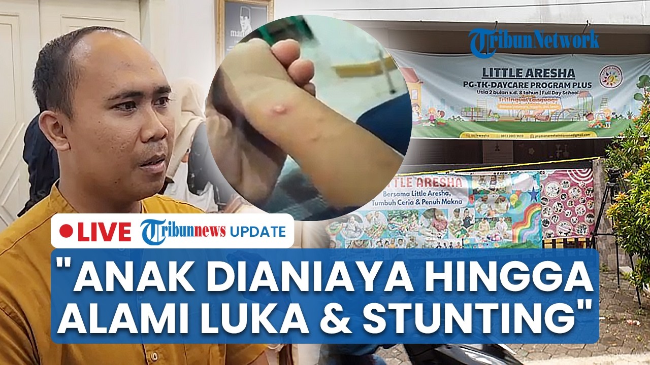 LIVE: Pengakuan Orang Tua Korban Daycare Jogja: Anak Dianiaya hingga Alami Luka Fisik & Stunting