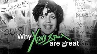 Why X-RAY SPEX are great