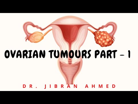 ENDOMETRIAL CARCINOMA II FEMALE GENITAL TRACT II ROBBINS 10TH E II PATHOLOGY LECTURE