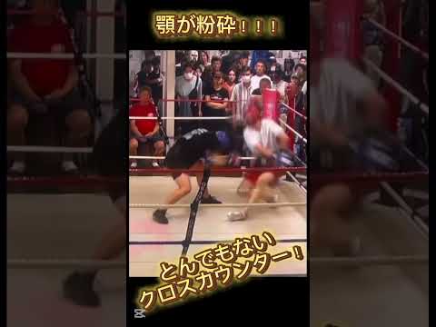 【顎が粉砕！どんでもないクロスカウンター】#shorts #sports #格闘技 #ufc #ボクシング #キックボクシング #那須川天心 #井上尚弥 #boxing #kickboxing #衝撃
