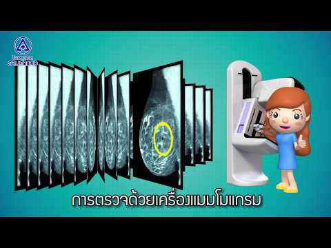 การเสริมเต้านม 3d ชุดว่ายน้ำสปอร์ตบนหน้าอกขนาดเล็ก