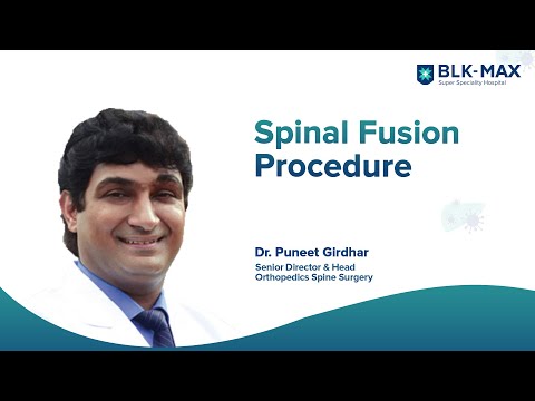 Minimally Invasive Spinal Fusion Procedure │ Dr. Puneet Girdhar | BLK-Max Hospital