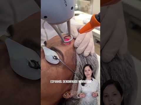 Alciara Lima .-25