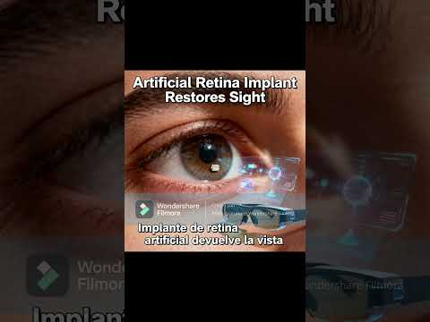 Artificial Retina Implant Restores Sight to Blind Patients:#ArtificialRetina #Blindness #medical