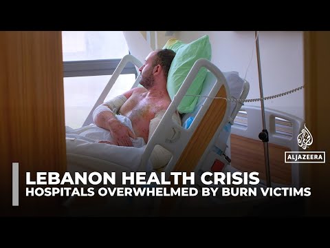 Lebanon’s hospitals overwhelmed as burn victims surge after Israeli strikes