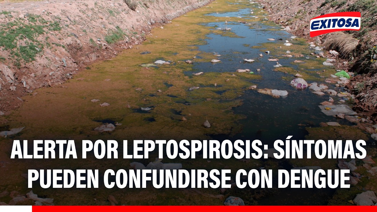 🔴🔵 Alerta por leptospirosis en Perú: Síntomas pueden confundirse con dengue