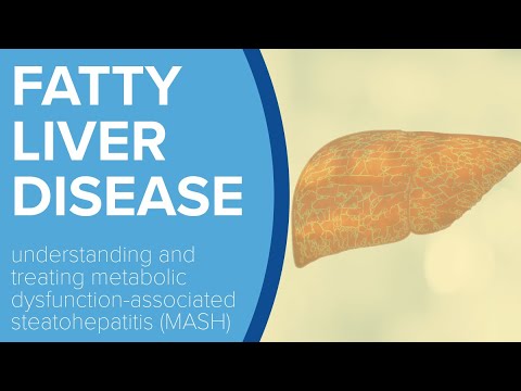 Fatty Liver Disease: MASH (formerly known as NASH) - Yale Medicine Explains